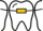 Studio Dentistico Levi | Ortodonzia fissa icon